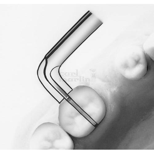 Carl Martin Kroonafnemer / Crown Remover Universeel #1111-Carl Martin-Sordent