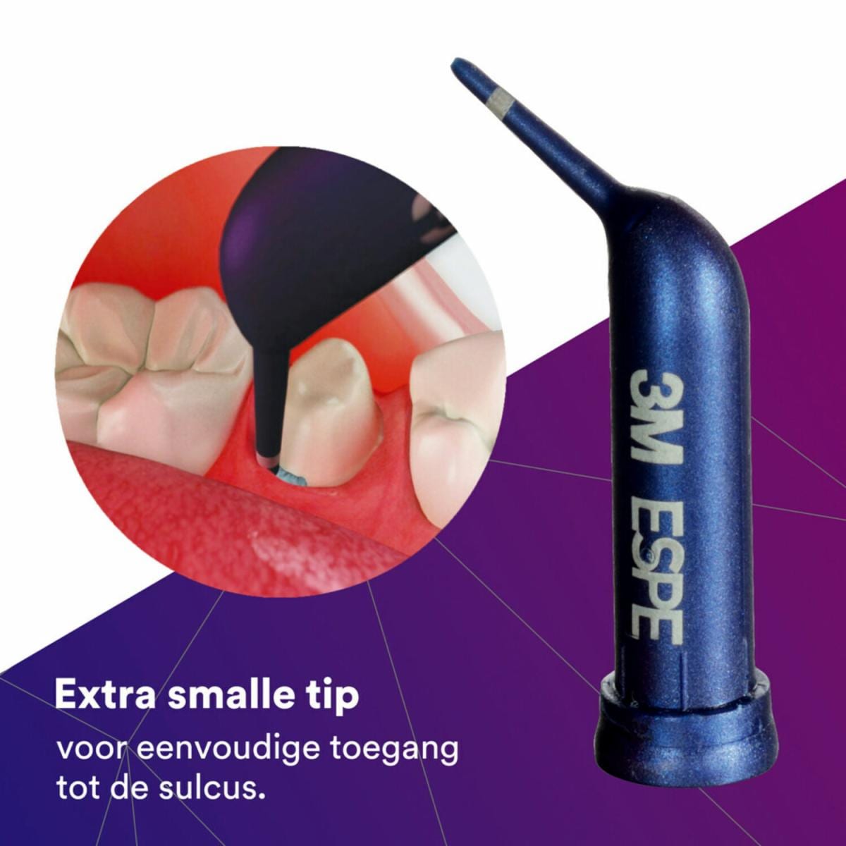 3M™ Astringent Retractiepasta - Value Pack - (100 Capsules)-Solventum-Sordent