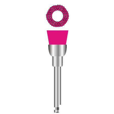 FHS Dental Polijstborstels Roze Soft RA (100 st.)-FHS Dental-Sordent