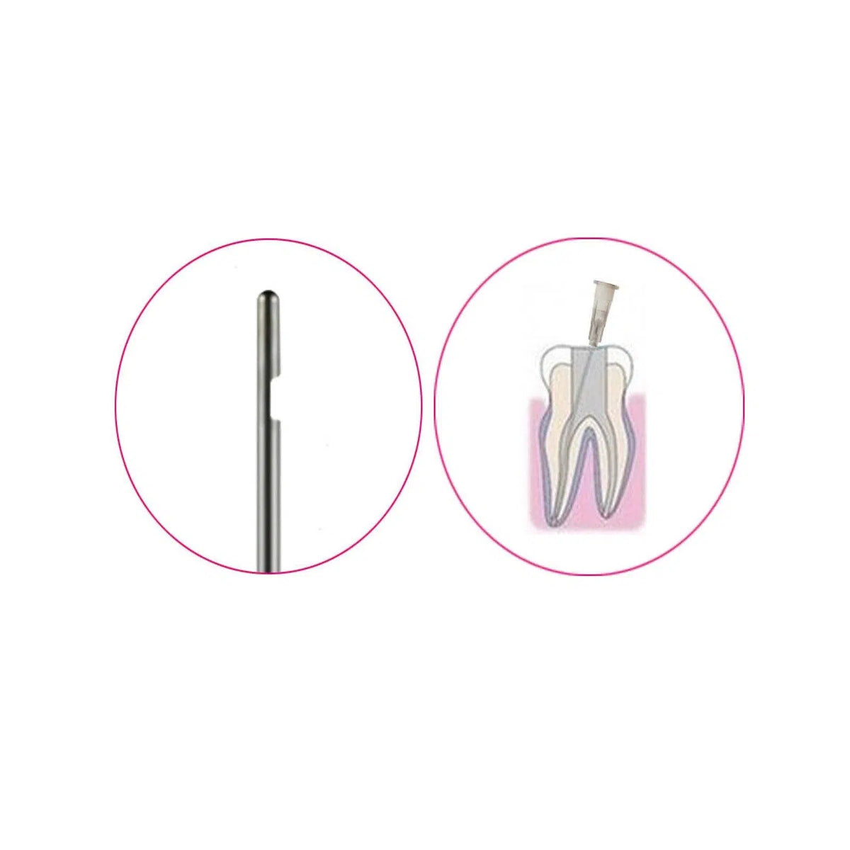 Endo Irrigatienaalden Side-Type (100 st.)-Disposables-Sordent-Sordent
