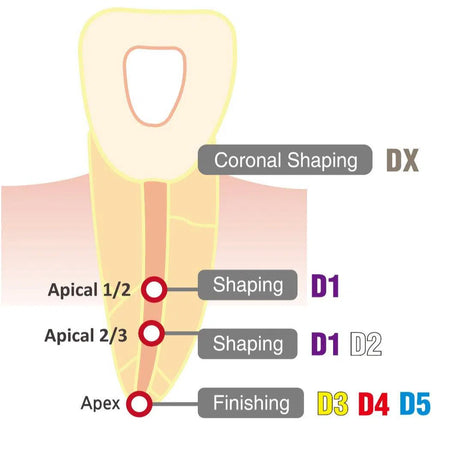 DIA-X (NiTi) Roterende Vijlen (#DX, #D1-5 - 19, 21, 25 mm)-Gezondheidszorg-DiaDent-Sordent
