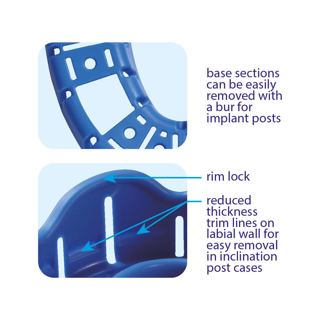 Premium Plus Disposable Afdruklepels / Impression Trays met Rim Lock-Premium Plus-Sordent