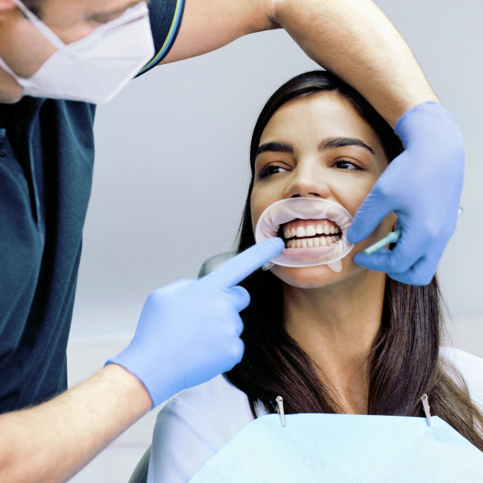 Ivoclar Vivadent OptraGate® Refill Junior (80 st.)-Ivoclar-Sordent