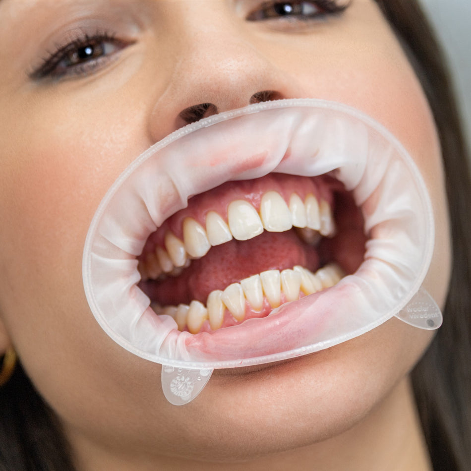 Ivoclar Vivadent OptraGate® Assortiment (80 st.)-Ivoclar-Sordent