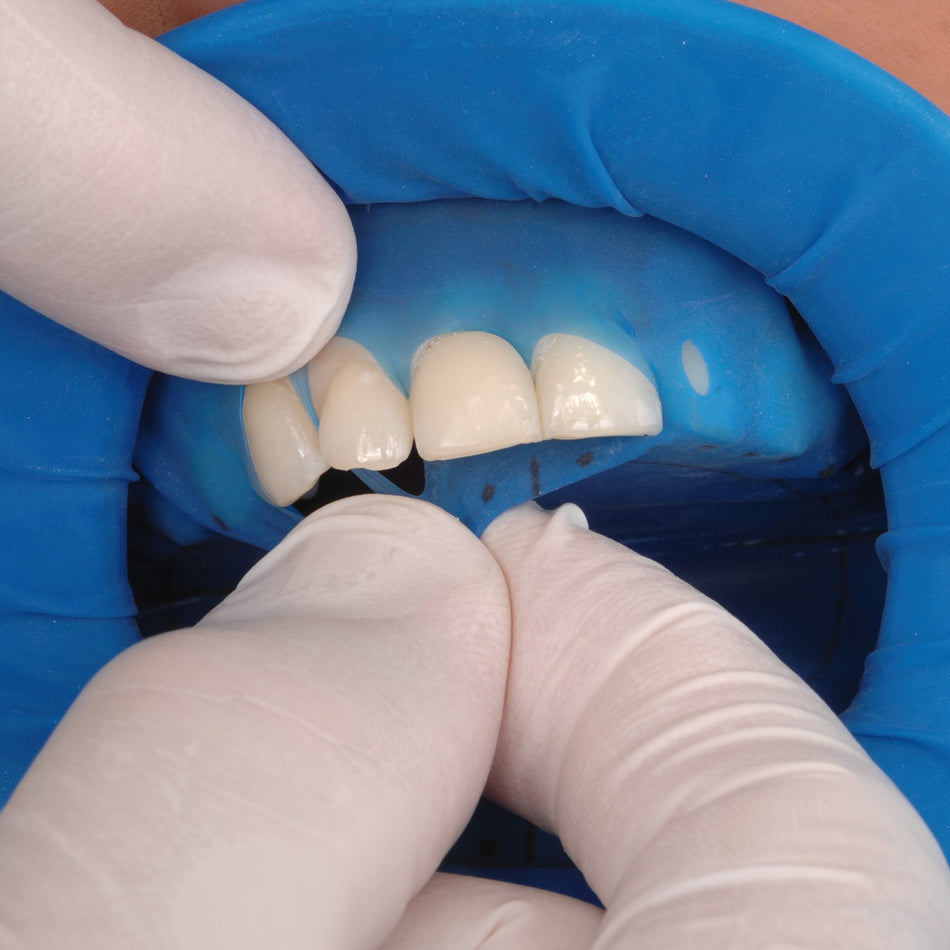 Ivoclar Vivadent OptraDam® Plus Assortiment (50 st.)-Ivoclar-Sordent