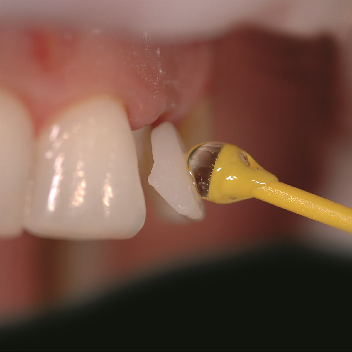 Ivoclar Vivadent OptraStick® Navulling (48 st.)-Ivoclar-Sordent