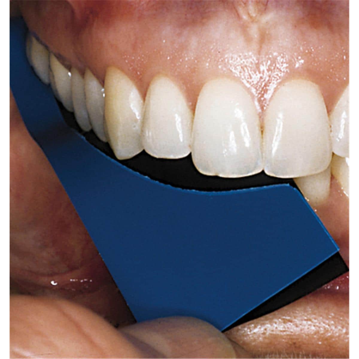 Directa Trollfoil Blauw - Ultradunne Articulatiefolie 8μ-Directa-Sordent