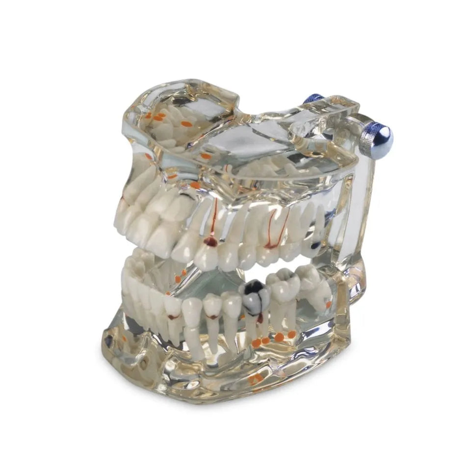 Lactona Transparant gebitsmodel (Demonstratiemodel ware grootte)-Lactona-Sordent