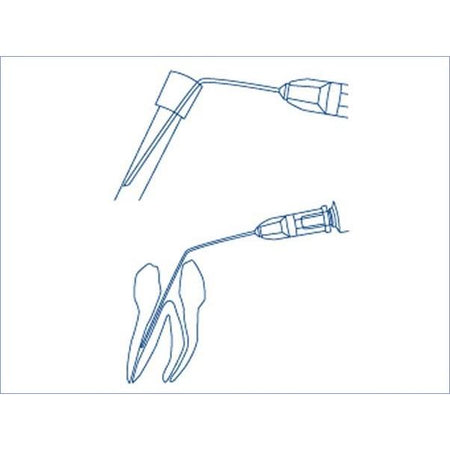 Miraject® Endo Luer Spoelnaald 30G Ø 0,3 mm / 40 mm (100 st.)-Hager & Werken-Sordent