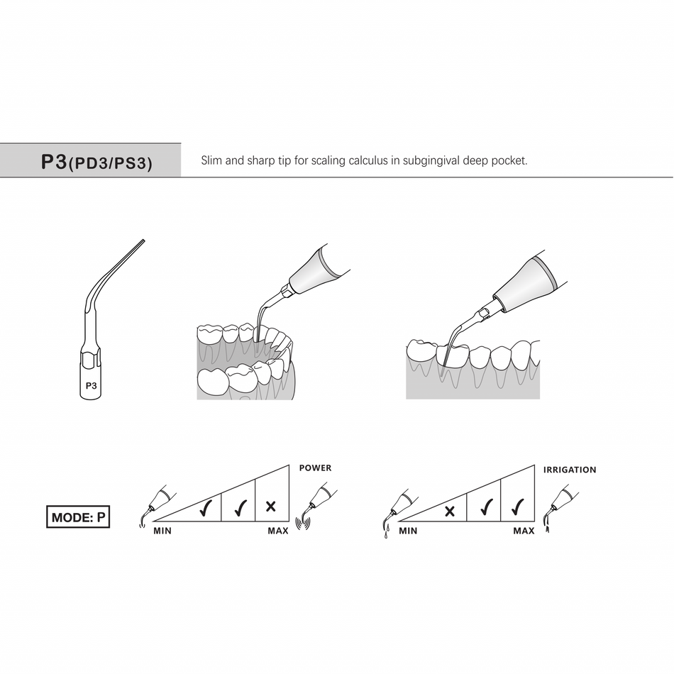 Premium Plus Refine Scaler Tip (P3, PD3 and PS3)-Premium Plus-Sordent