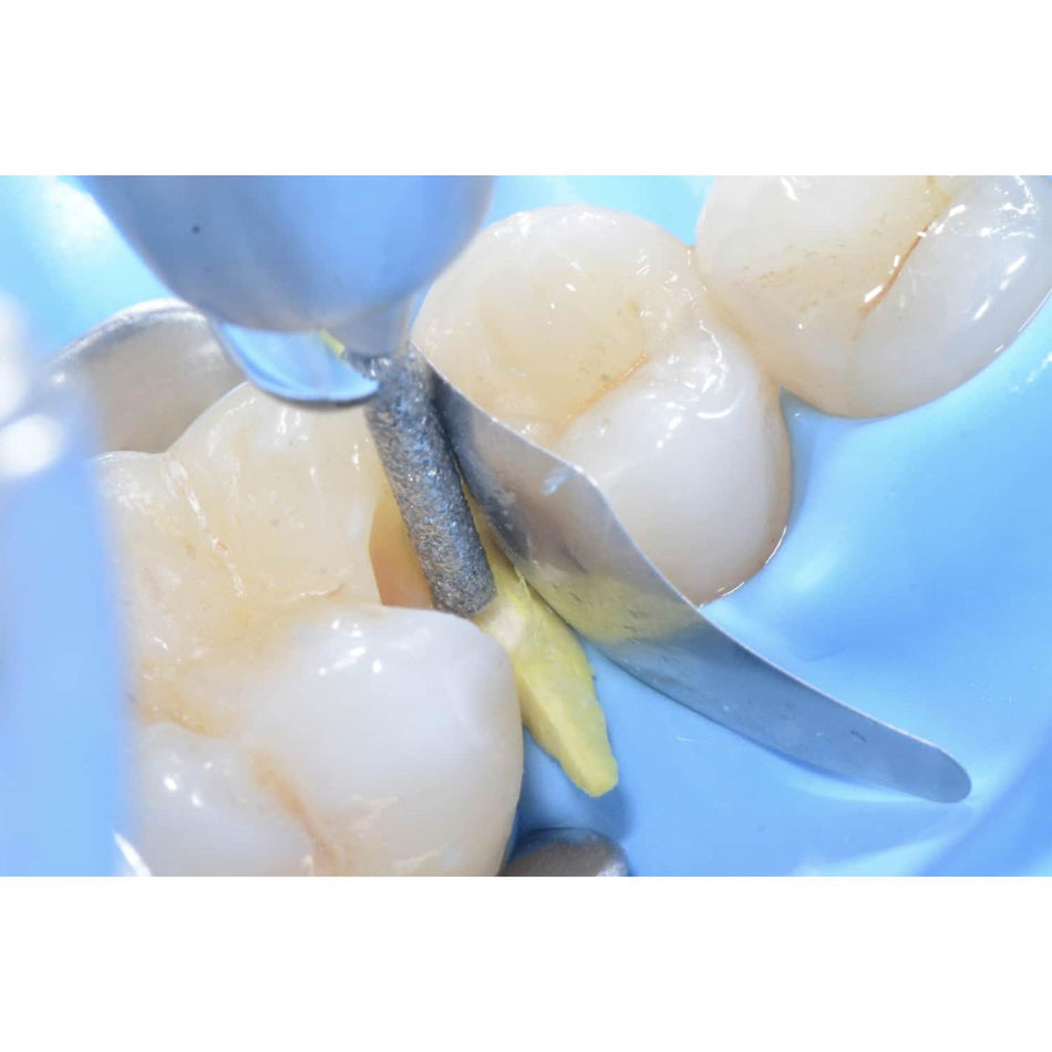 Polydentia PolydentiaPRO Interproximale tandbescherming (100 st.)-Polydentia-Sordent