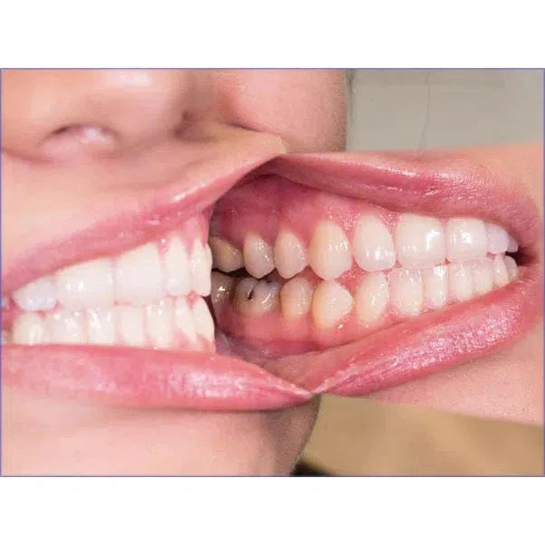 Reflect-Rhod Rhodium-Coated Mondspiegel (Fotografie) - (Nr. 1/2/3)-Hager & Werken-Sordent