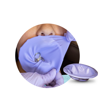 Zirc Insti-Dam Cofferdam Relaxed Fit Lila (20 st.)-Zirc-Sordent