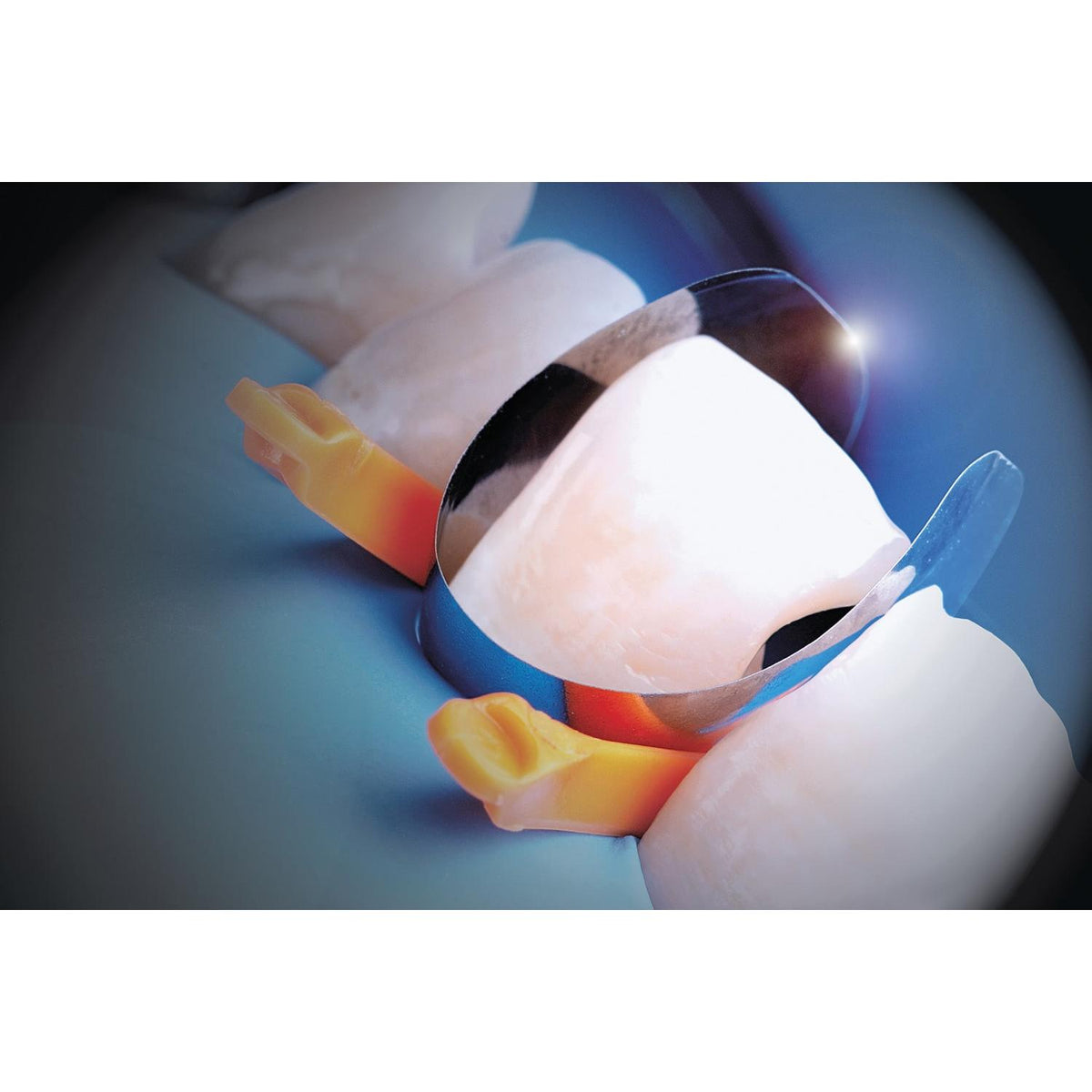 Polydentia Unica anterior Matrix 0,03mm-Polydentia-Sordent