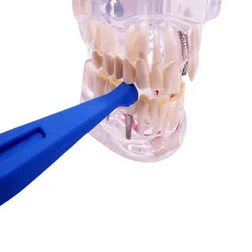 Tooth Slooth Crack Locator Licht Blauw-Praktijkbenodigheden-Sordent-Sordent