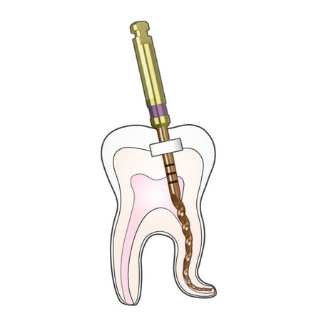 DIA-X (NiTi) Roterende Vijlen (#DX, #D1-5 - 19, 21, 25 mm)-Gezondheidszorg-DiaDent-Sordent