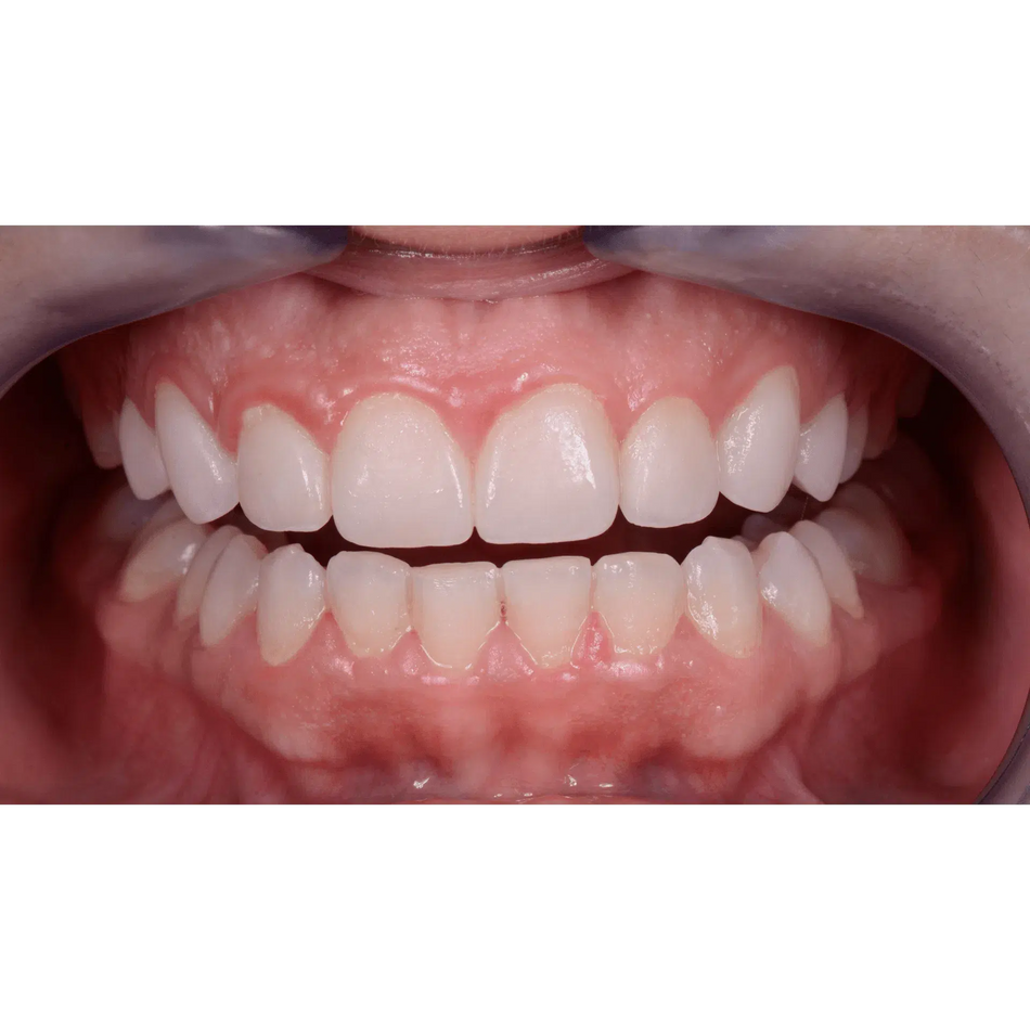 EMS Biofilm Discloser / Disclosing Pellets Plaqueverklikker (250 st.)-E.M.S.-Sordent