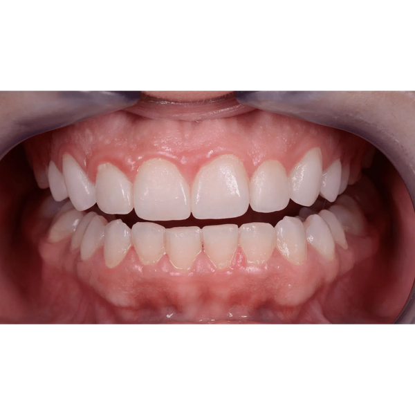 EMS Biofilm Discloser / Disclosing Pellets Plaqueverklikker (250 st.)-E.M.S.-Sordent