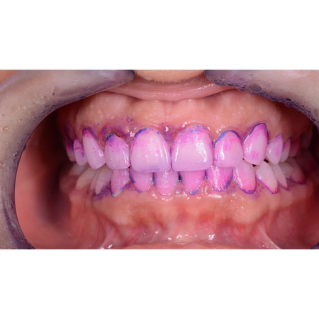 EMS Biofilm Discloser / Disclosing Pellets Plaqueverklikker (250 st.)-E.M.S.-Sordent