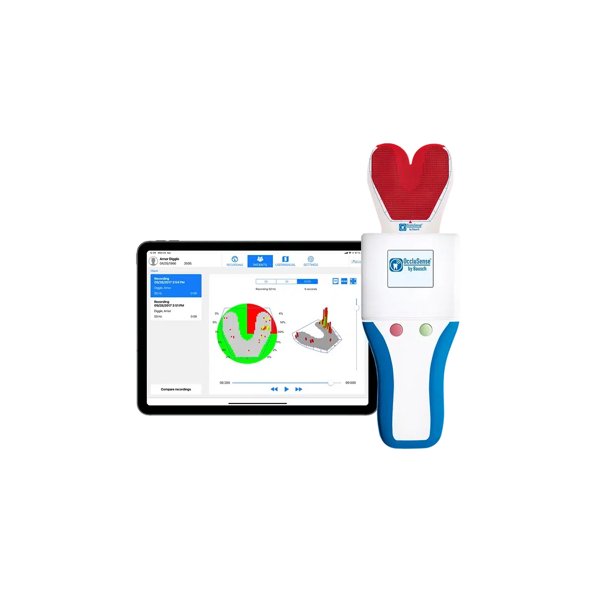 Bausch OccluSense® Set BK 5000 - Digitale Occlusiemeting en Analyse-Bausch-Sordent