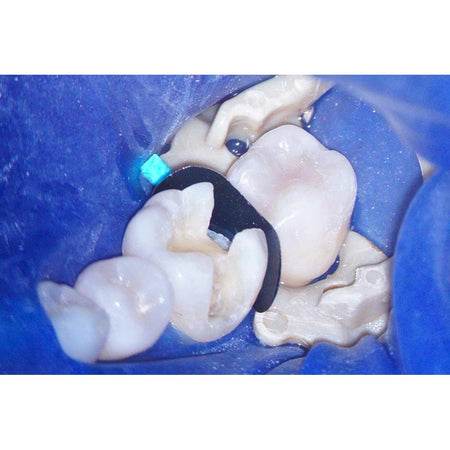 Polydentia LumiContrast Sectional Matrix (70 st.)-Polydentia-Sordent