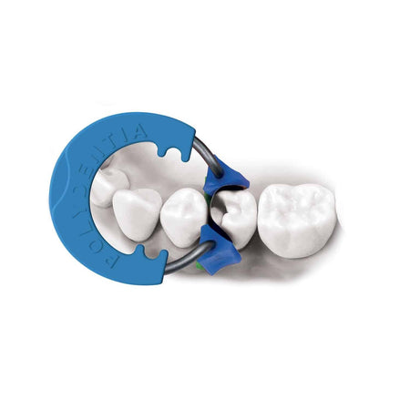 Polydentia myQuickmat Classico Kit - Compleet sectiematrixsysteem-Polydentia-Sordent