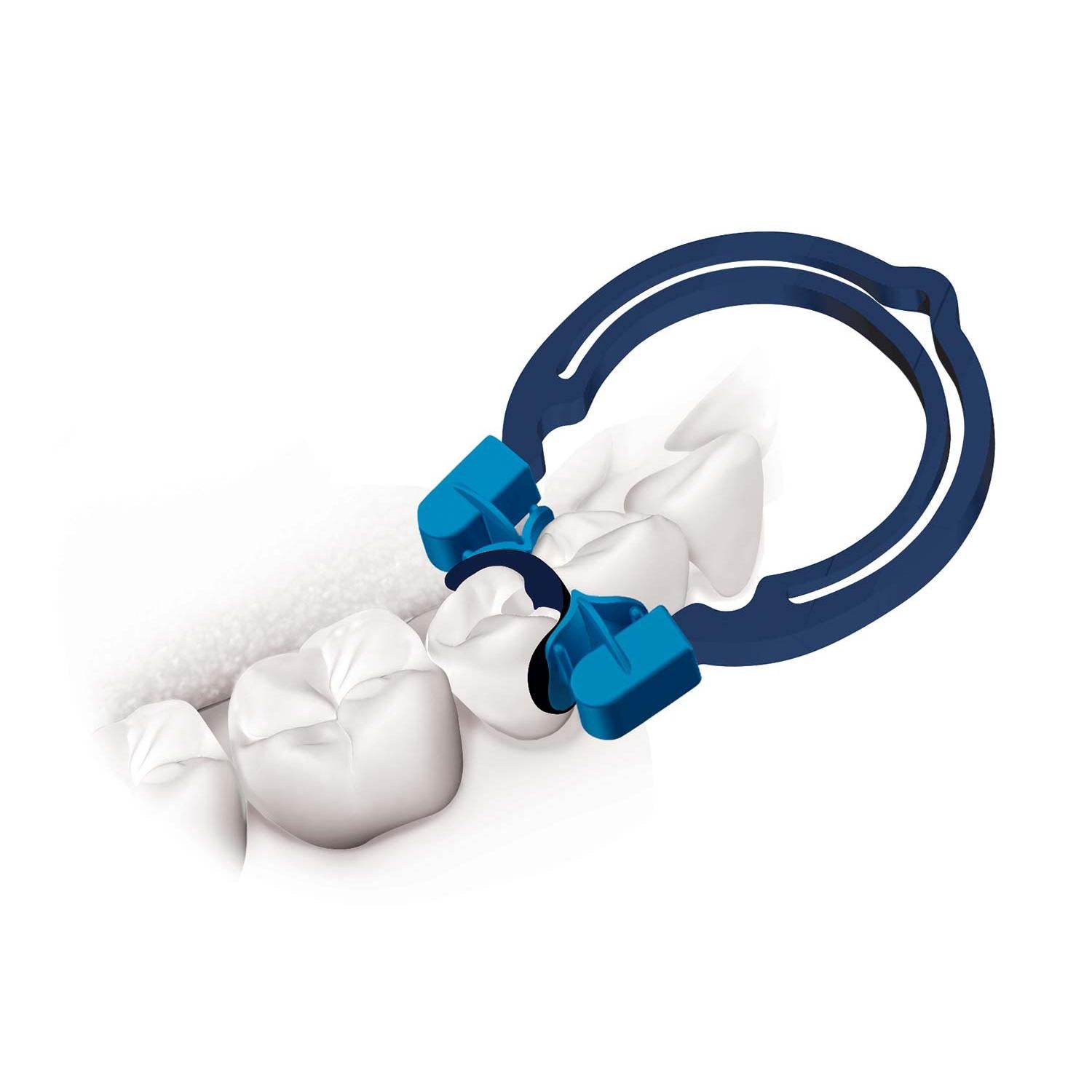 Polydentia myQuickmat Forte Kit - Compleet sectiematrixsysteem-Polydentia-Sordent