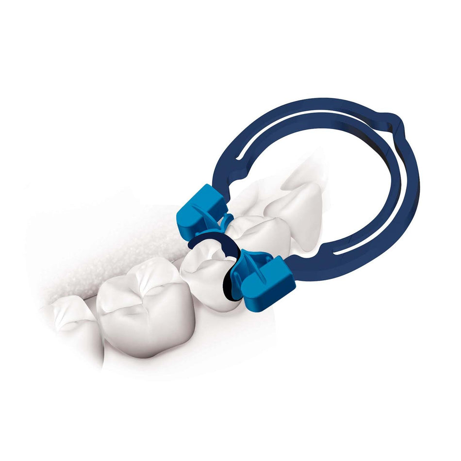 Polydentia myQuickmat Forte Kit - Compleet sectiematrixsysteem-Polydentia-Sordent