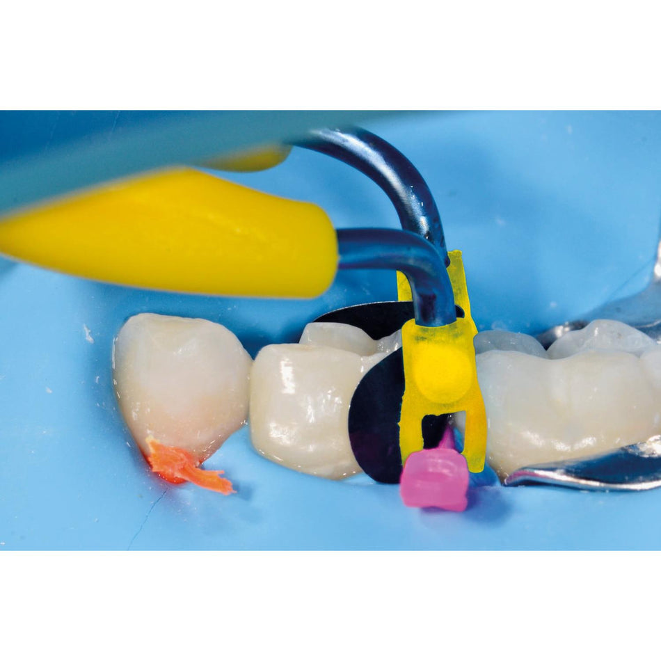 Polydentia myTines Junior voor myRing Junior & myClip Junior (15 paar)-Polydentia-Sordent