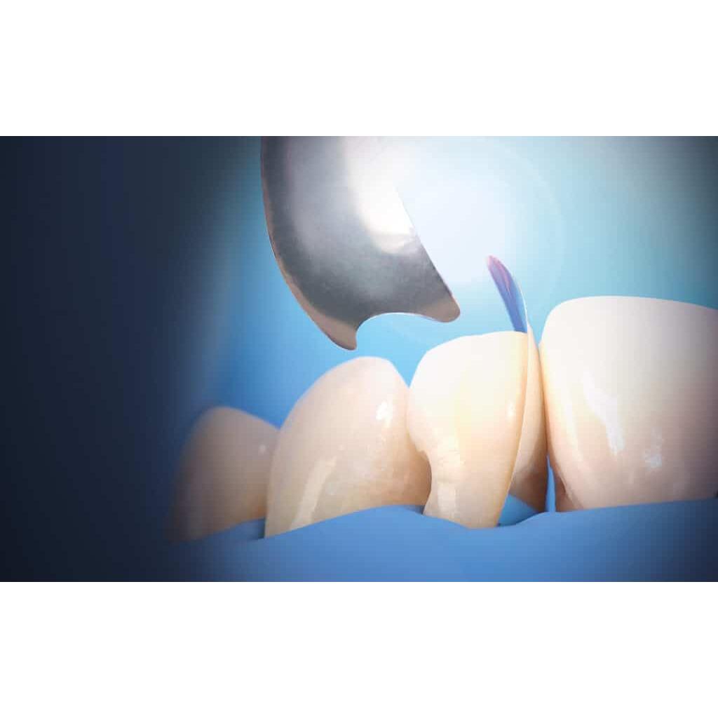 Polydentia Unica Proximal anterior Matrix 0,03mm-Polydentia-Sordent